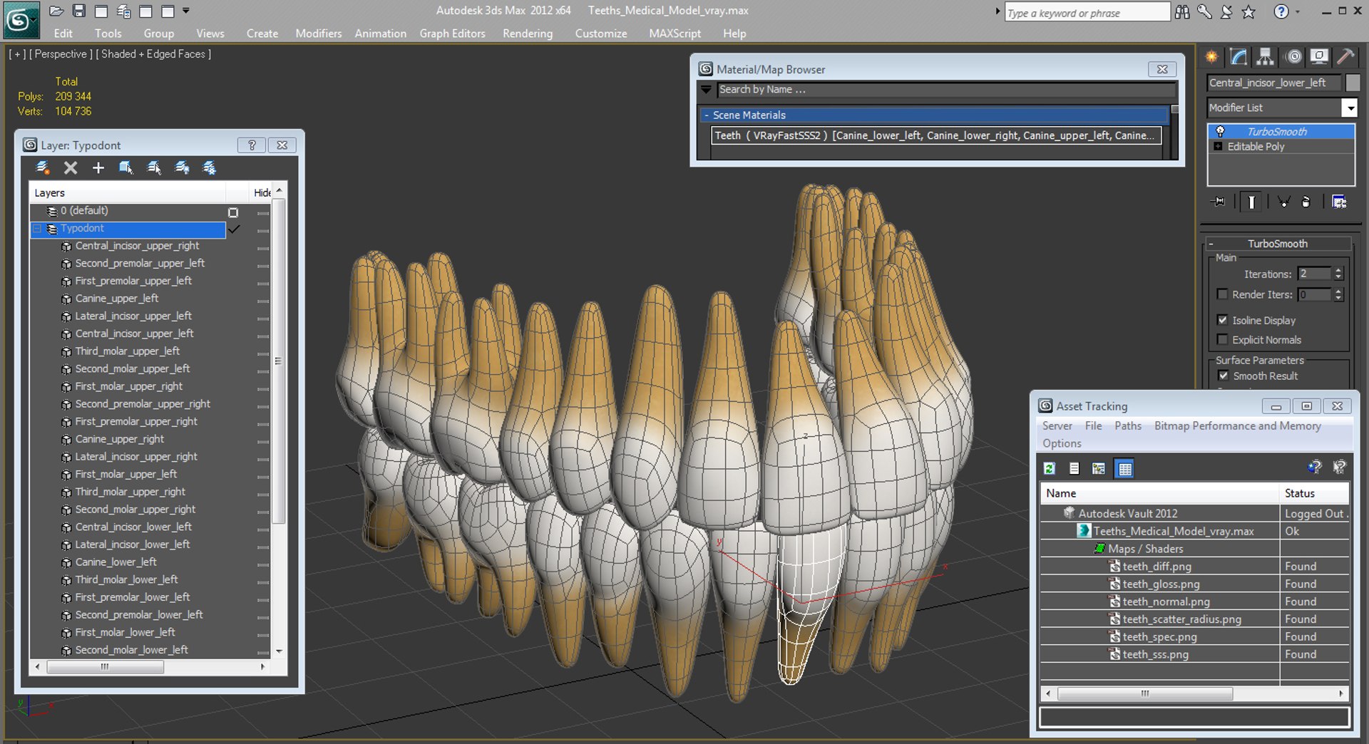 3D teeths medical modeled model https://p.turbosquid.com/ts-thumb/mt/5JAGry/hFnGOCIM/teethsmedicalmodelmb3dmodel017/jpg/1527001780/1920x1080/fit_q87/496e82416b63cc72794a43a3d23f89617e174c0d/teethsmedicalmodelmb3dmodel017.jpg