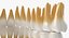 Teeths 의료 모델