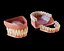 Denti umani