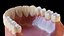 Denti umani