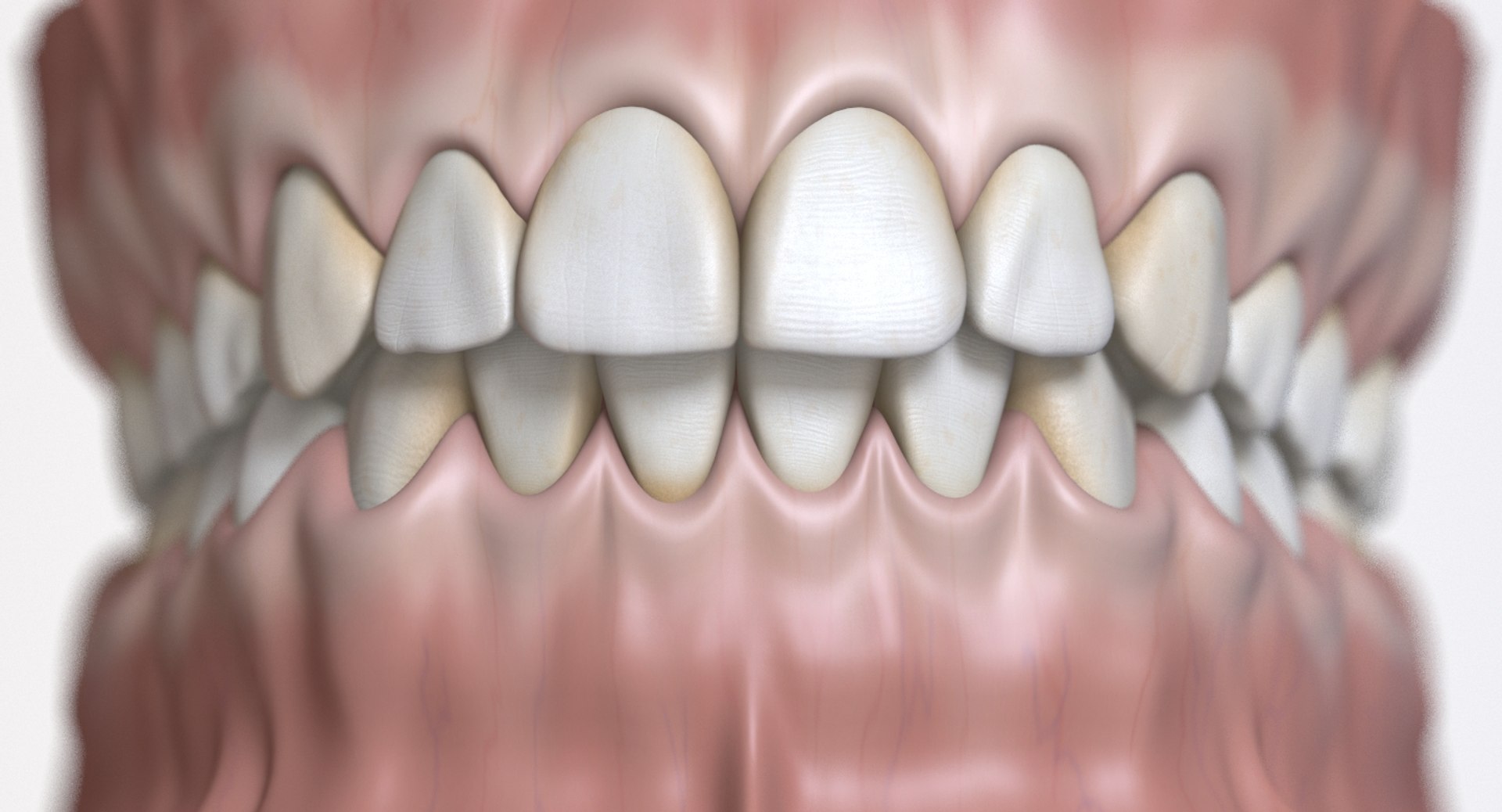 dentition stylized 3D model https://p.turbosquid.com/ts-thumb/mx/Ae8pEn/d019RQ4t/03/jpg/1496151804/1920x1080/fit_q87/335e342b7619fb52449080cefd169709de9567fe/03.jpg