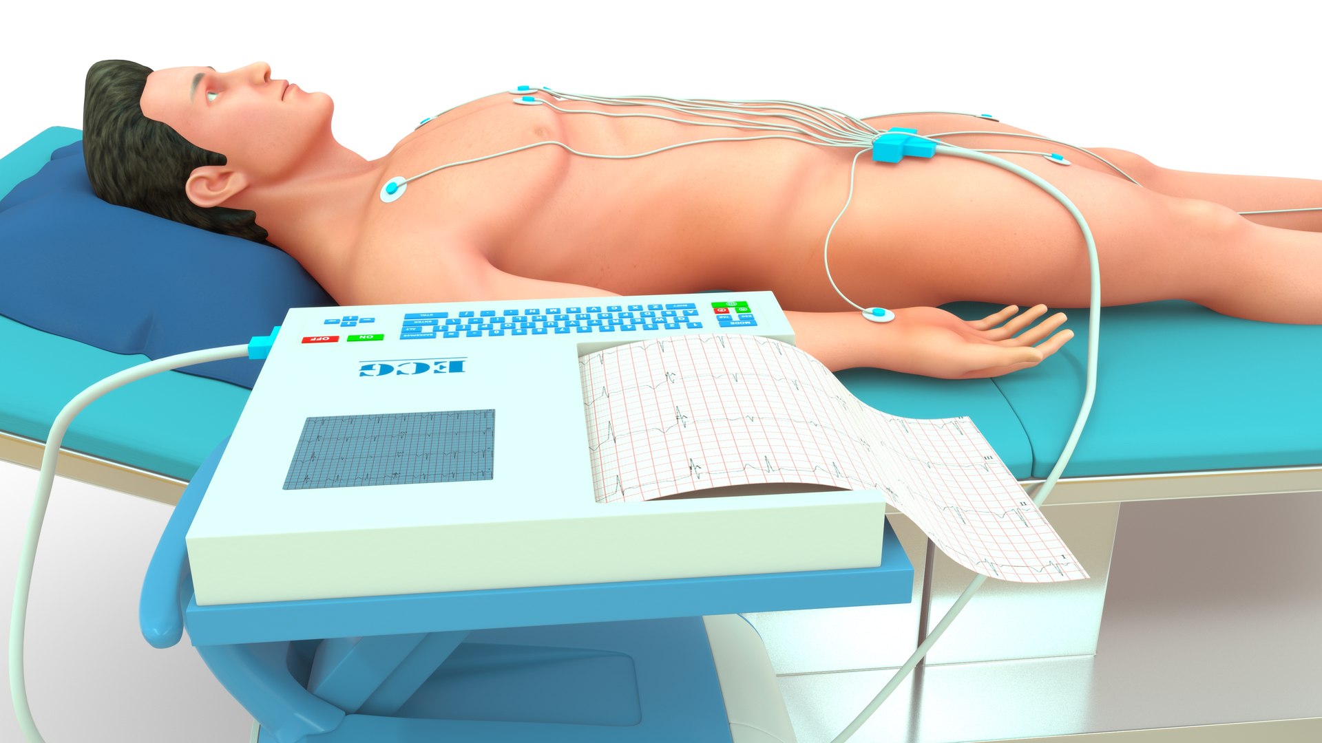 ecg machine with patient 3D https://p.turbosquid.com/ts-thumb/n1/mVcSPq/eB/m0195_ecg_machine_with_patient_0006/jpg/1731578482/1920x1080/fit_q87/3e87a4cb43157daa5bac09379ec8e50f7ad2a937/m0195_ecg_machine_with_patient_0006.jpg
