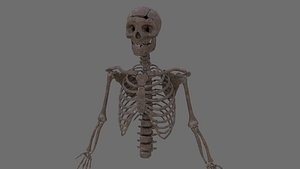 Skeleton Top Half with Bullet Hole in Head