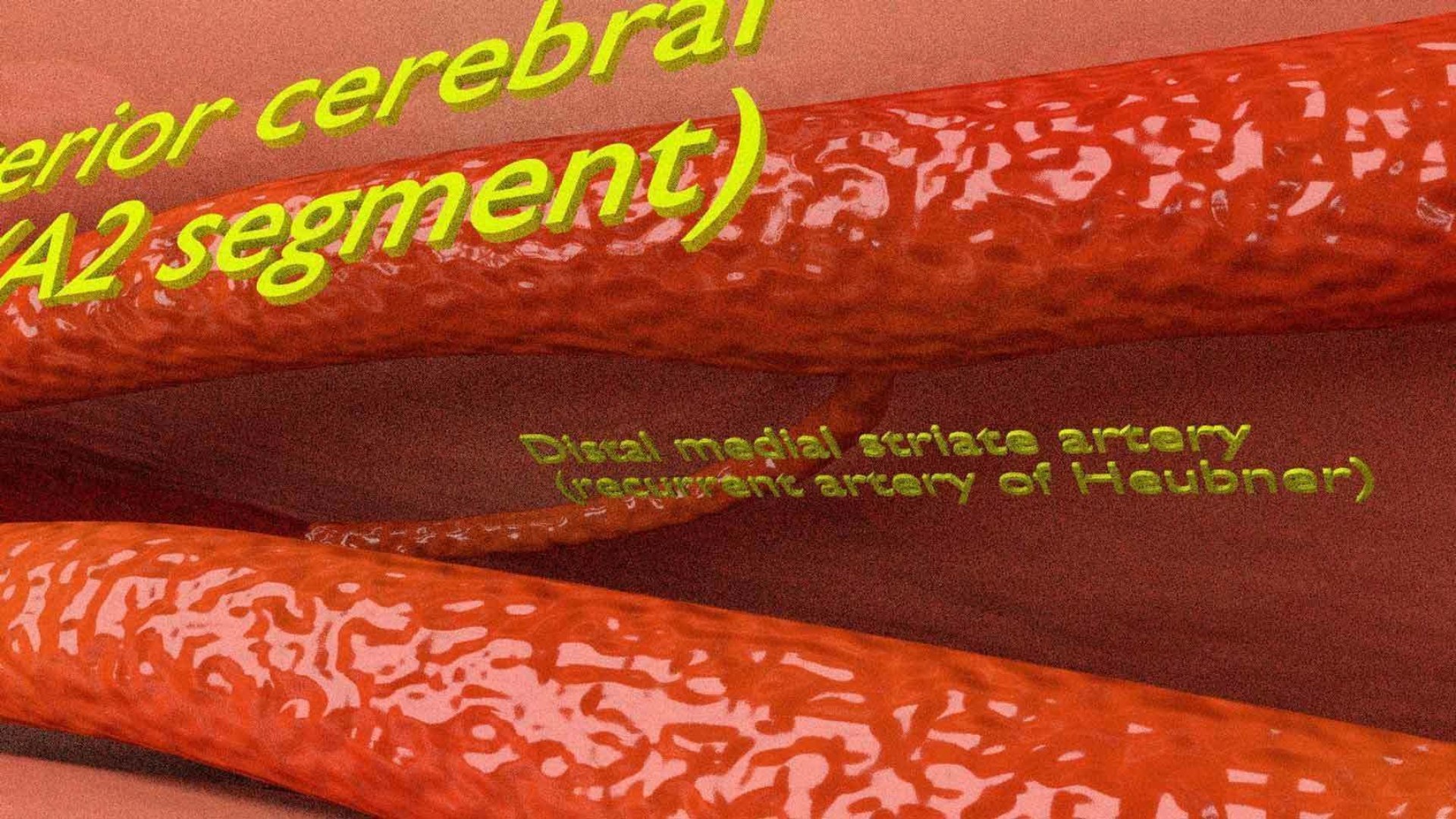 3D CIRCLE OF WILLIS 3D Model - TurboSquid 2046081