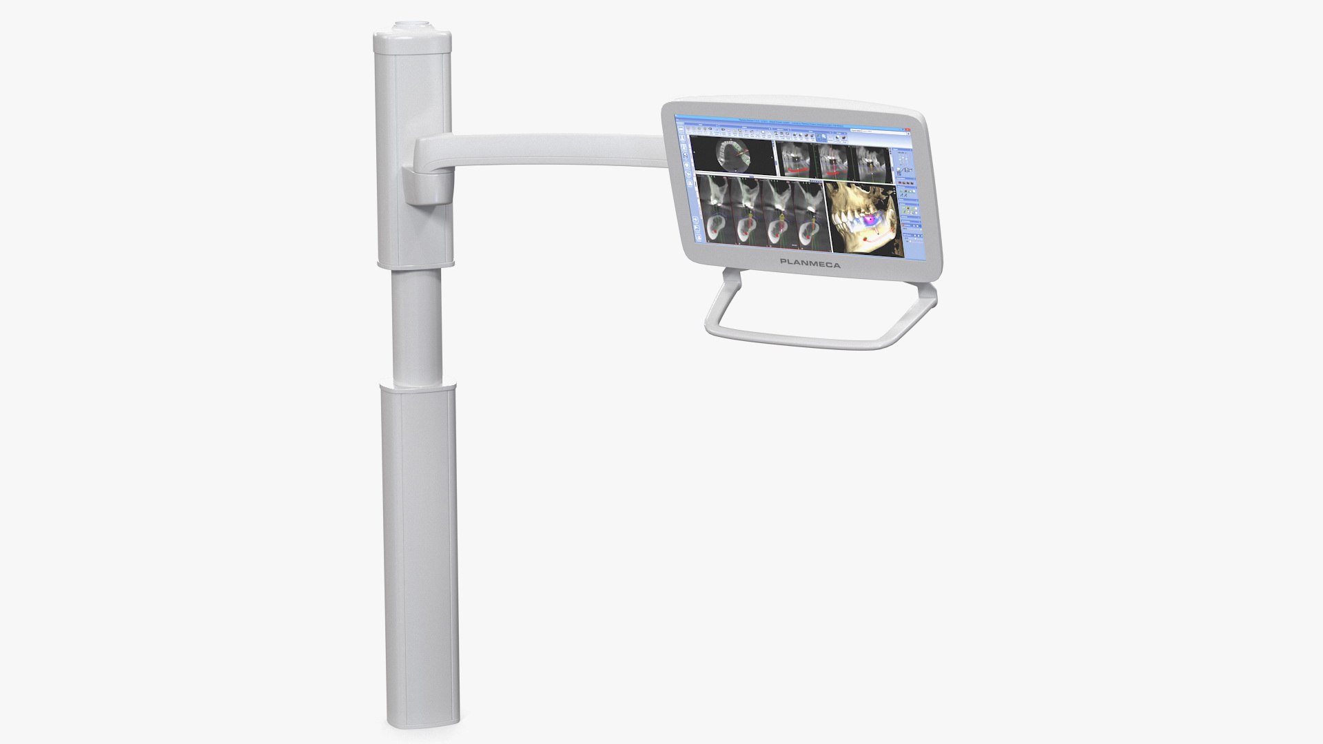 Planmeca Serenus Medical Display 3D model preview