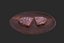 Conjunto de carne