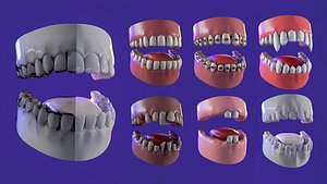 7 Teeth kit game ready pbr model Low-poly 3D model 3D model