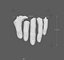 Severed Fingers