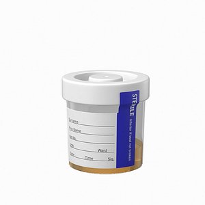 Urine Test Cup With Urine