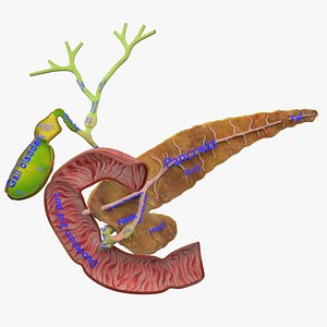 3D Biliary tract stone obstructions gallstone