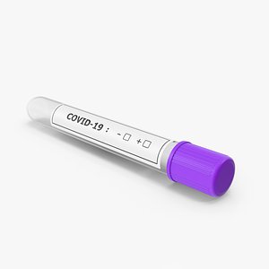 Coronavirus Test Tube