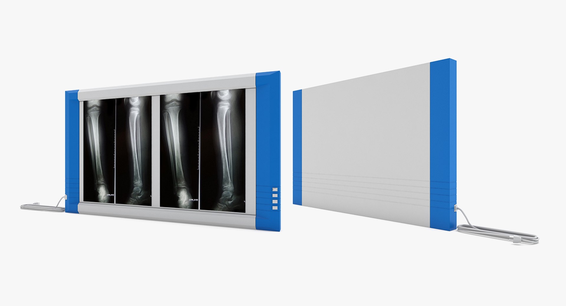 medical - x 3D model https://p.turbosquid.com/ts-thumb/nm/3gDYH7/4KetlhiZ/003/jpg/1533001415/1920x1080/fit_q87/913b0f1bc4ca78f5c720a9cc38fba5d5e3749402/003.jpg