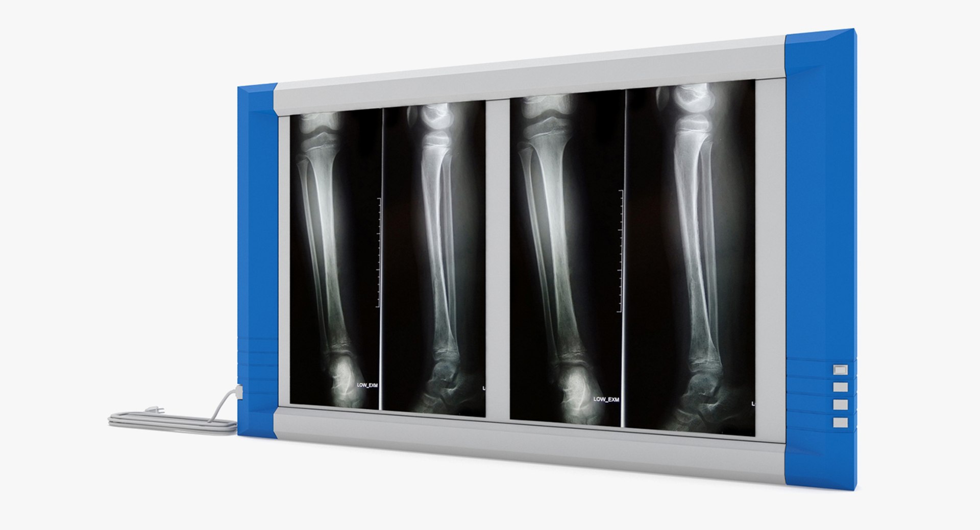 medical - x 3D model https://p.turbosquid.com/ts-thumb/nm/3gDYH7/Xxb44ak7/005/jpg/1533001415/1920x1080/fit_q87/5030847f53618bae2fa4660358113352f79d71a1/005.jpg