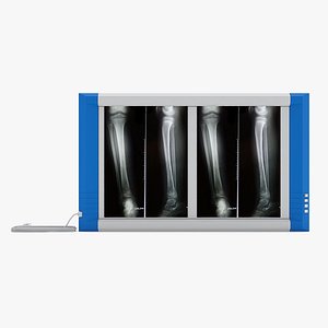 Medical - XRay Light Box