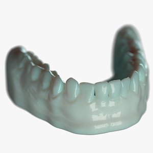 3D Lower Denture D Mold model