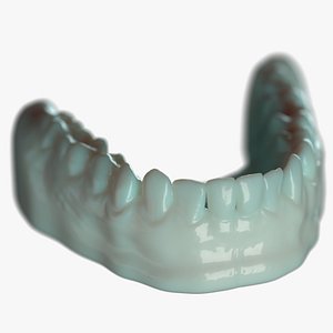 Lower Denture D Mold