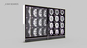 X-Ray Boards Monitor