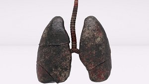Smoker Human lungs 3D model