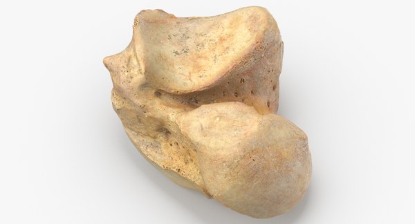 Osso Do Talus Rotulado Talus | Radiology Reference Article