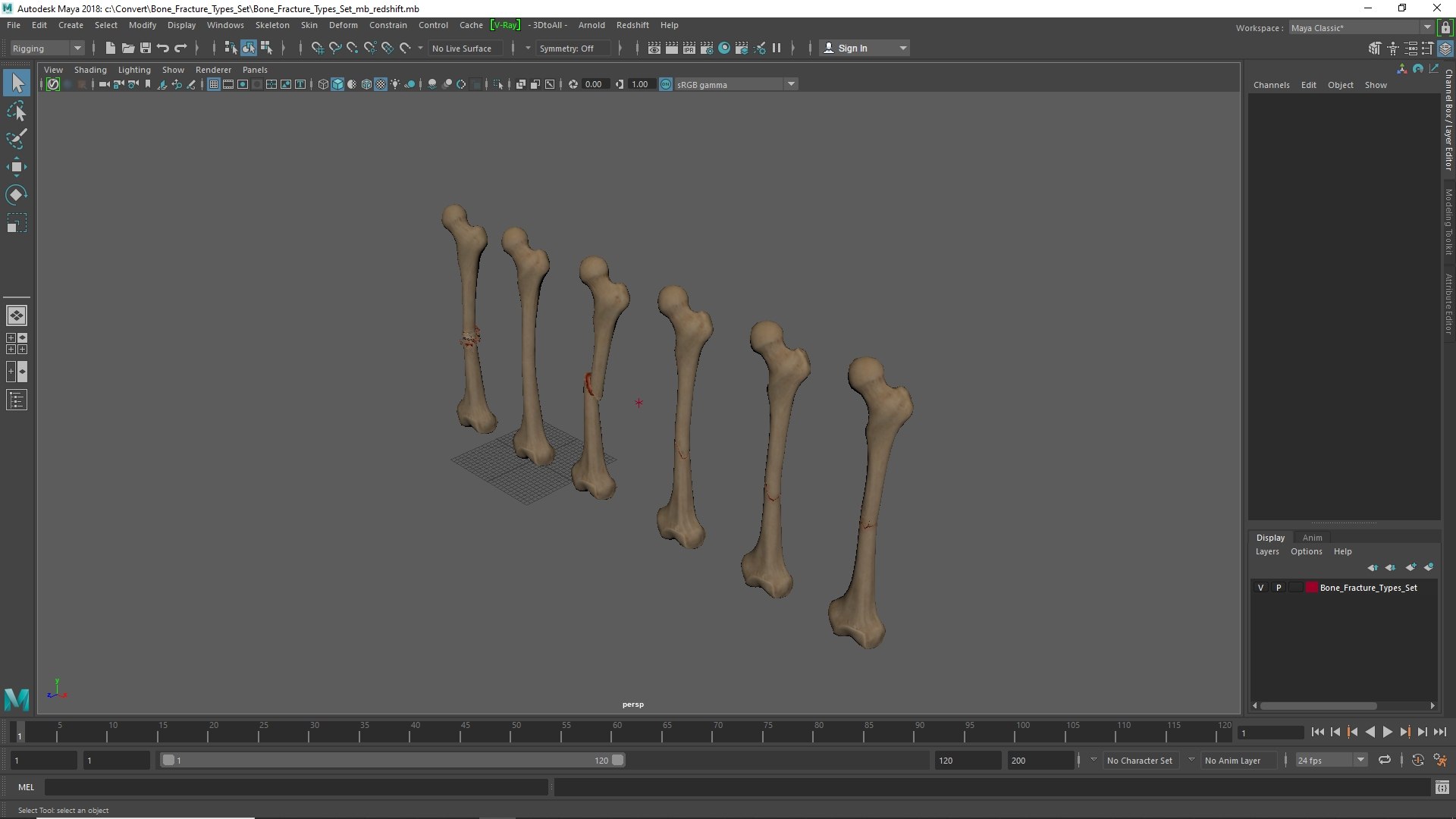 3D Bone Fracture Types Set model https://p.turbosquid.com/ts-thumb/oD/2ivzLc/ap/bone_fracture_types_set_1002/jpg/1782796356/1920x1080/fit_q87/606cbe883f15055217dcea3f0e20f094e87ee4e2/bone_fracture_types_set_1002.jpg
