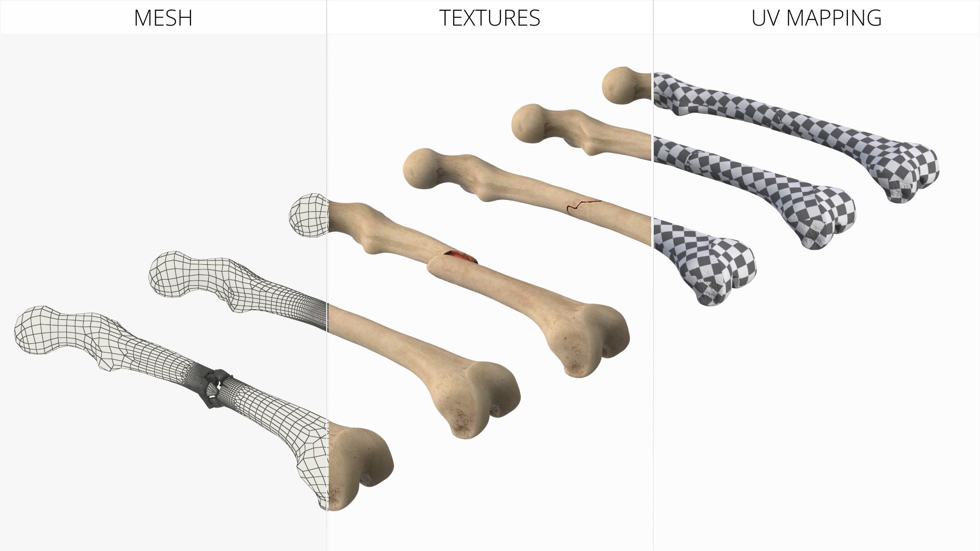 3D Bone Fracture Types Set model https://p.turbosquid.com/ts-thumb/oD/2ivzLc/nA/bone_fracture_types_set_010/jpg/1782796333/1920x1080/fit_q87/af531fad3f26b5cfa0c151542d63a22c658aab04/bone_fracture_types_set_010.jpg