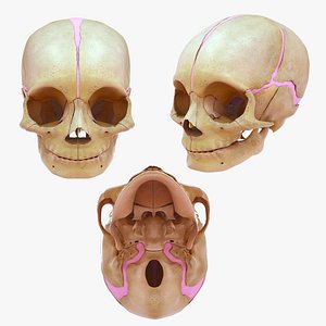 3D skull of a newborn baby