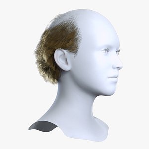 3D Norwood Stage 7 Balding Haircut - Real-time Hair Cards