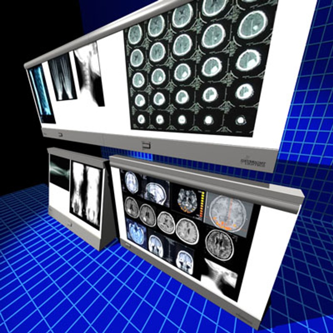 max xray light box 01