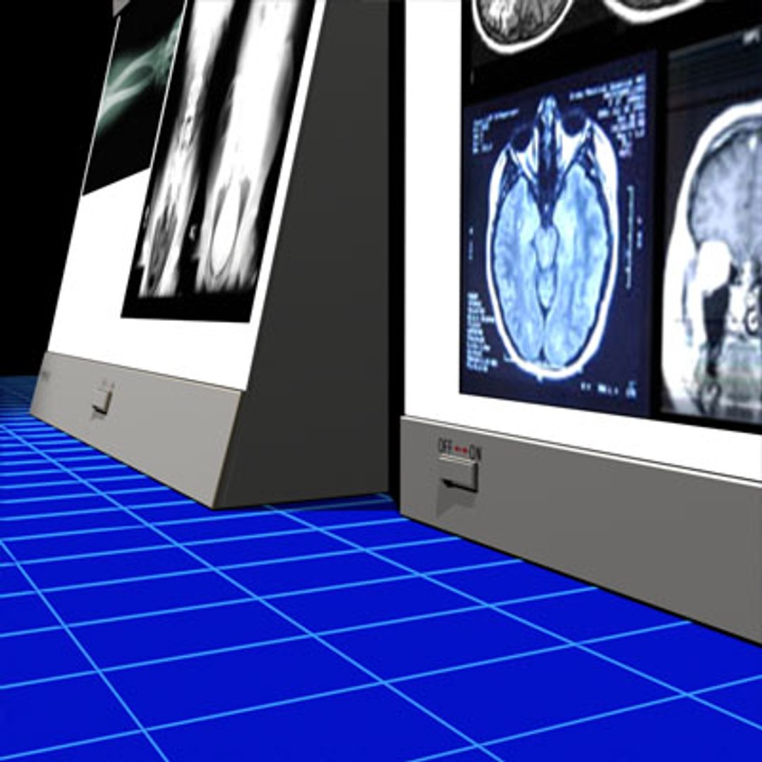 max xray light box 01