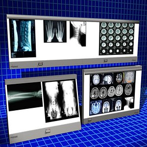 Xray Light Boxes 01