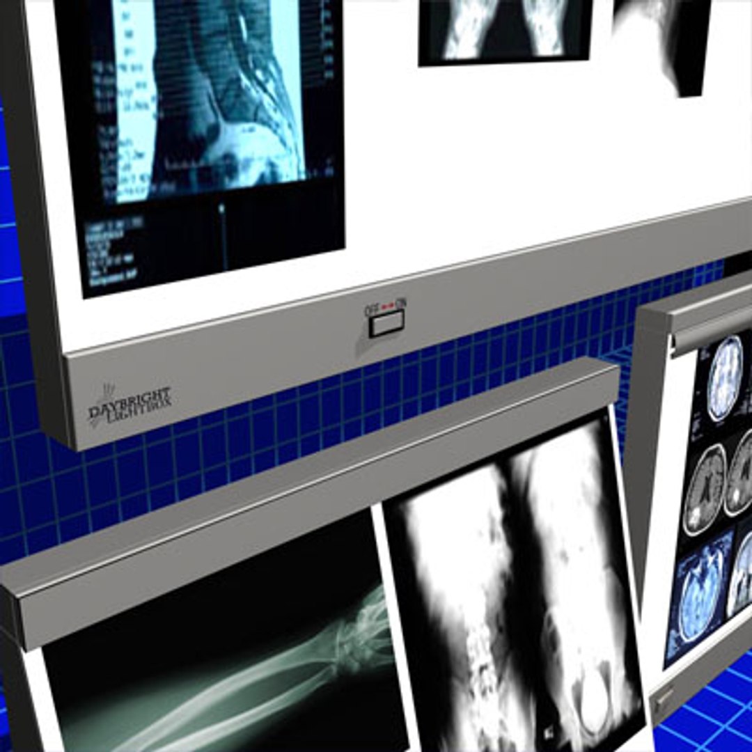 max xray light box 01