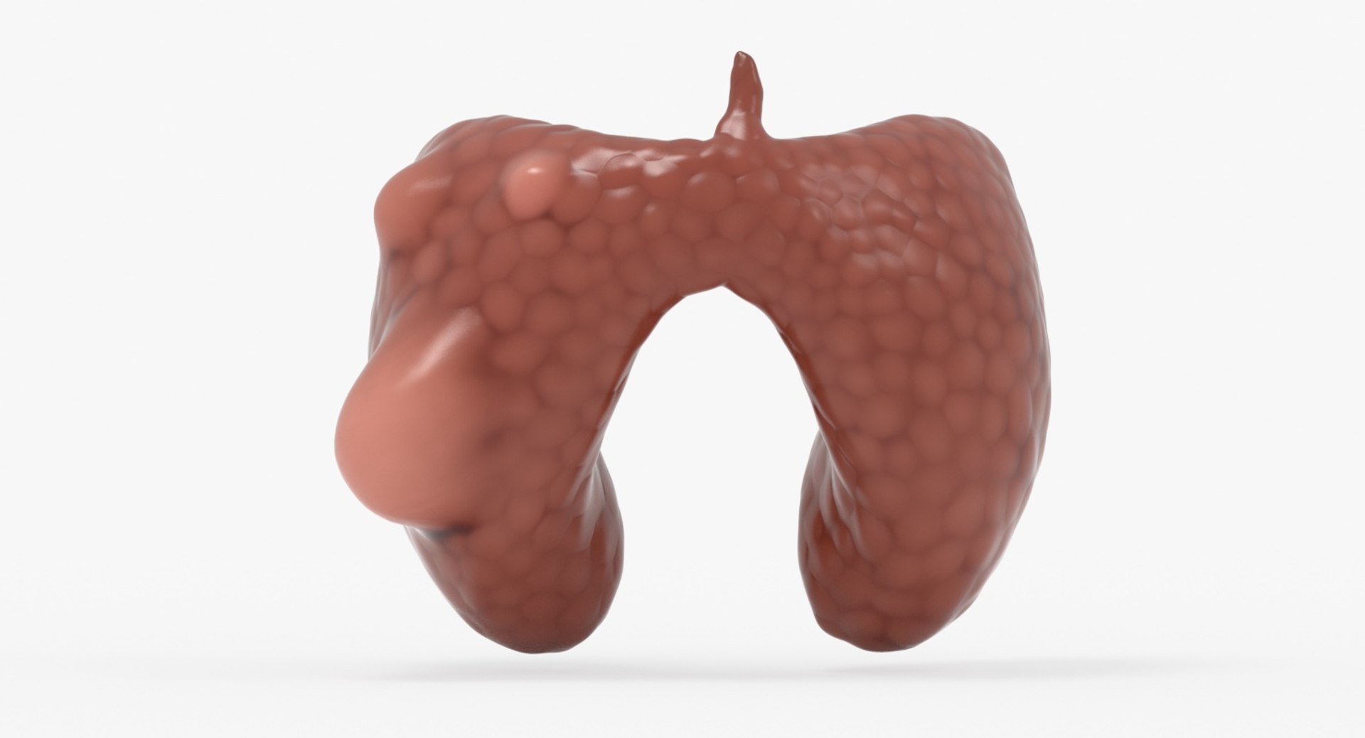 papillary cancer thyroid 3D model https://p.turbosquid.com/ts-thumb/oe/kvoIUx/1EjRq23U/12_front_view/jpg/1546076093/1920x1080/fit_q87/7652f23fad680d80f067e2617416bc37917f288b/12_front_view.jpg