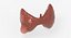 Papillary Cancer Thyroid