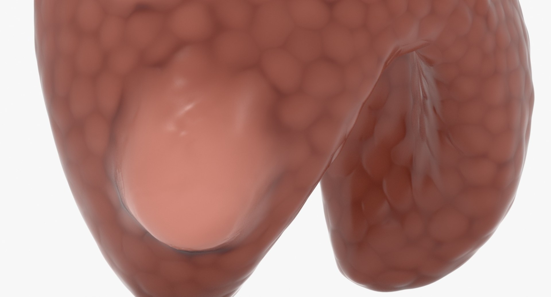 papillary cancer thyroid 3D model https://p.turbosquid.com/ts-thumb/oe/kvoIUx/58SNkIF7/16_close_view/jpg/1546076094/1920x1080/fit_q87/f08f926232f717da15bead48a90f8375a68f8e58/16_close_view.jpg