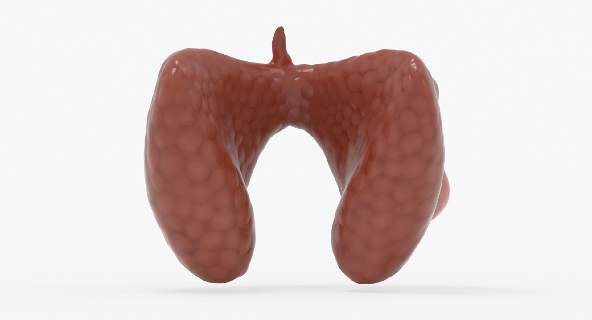 papillary cancer thyroid 3D model https://p.turbosquid.com/ts-thumb/oe/kvoIUx/ITRdzNaR/13_back_view/jpg/1546076093/1920x1080/fit_q87/7390882f4e2fb25333e7dfcacbcc5d6b81ddbc33/13_back_view.jpg