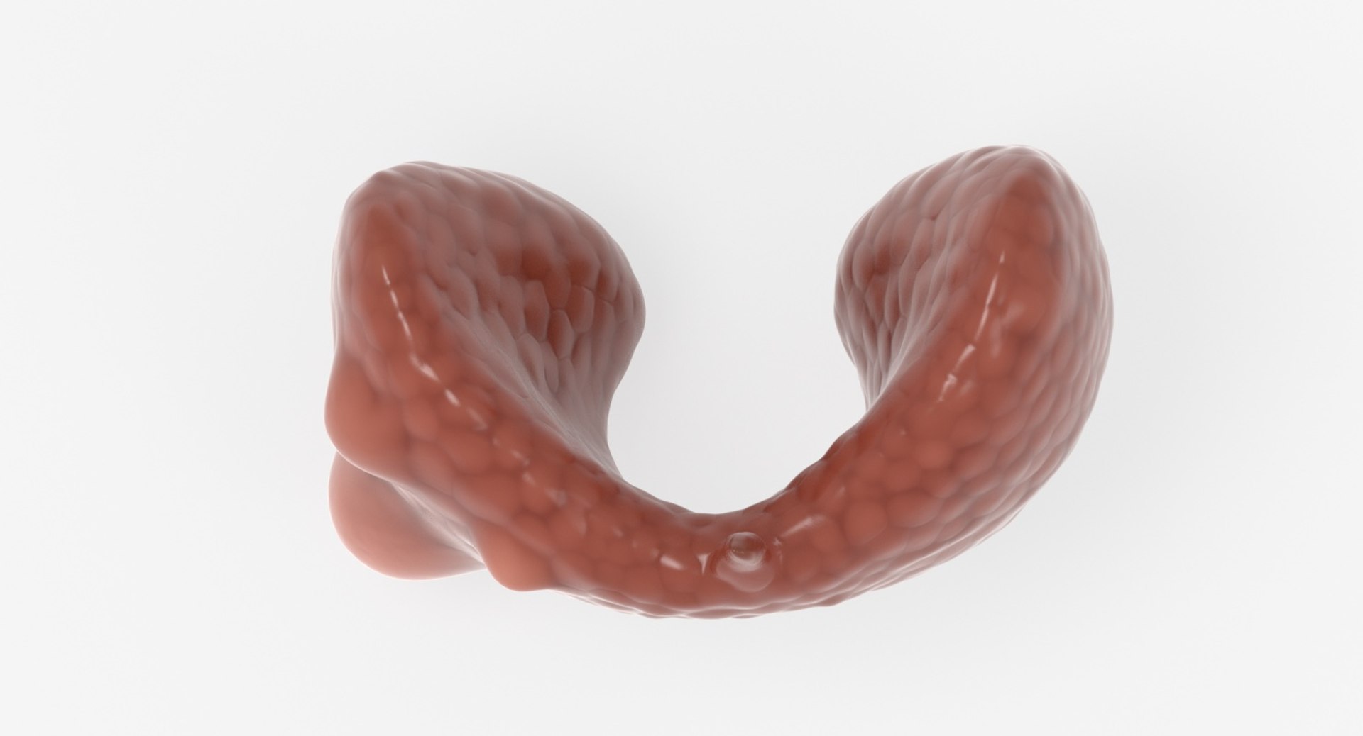 papillary cancer thyroid 3D model https://p.turbosquid.com/ts-thumb/oe/kvoIUx/Qibo3hNn/15_up_view/jpg/1546076093/1920x1080/fit_q87/c9d62c896b35ddd4d527cc62fcca67fe5c5cd50f/15_up_view.jpg