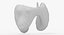 Papillary Cancer Thyroid