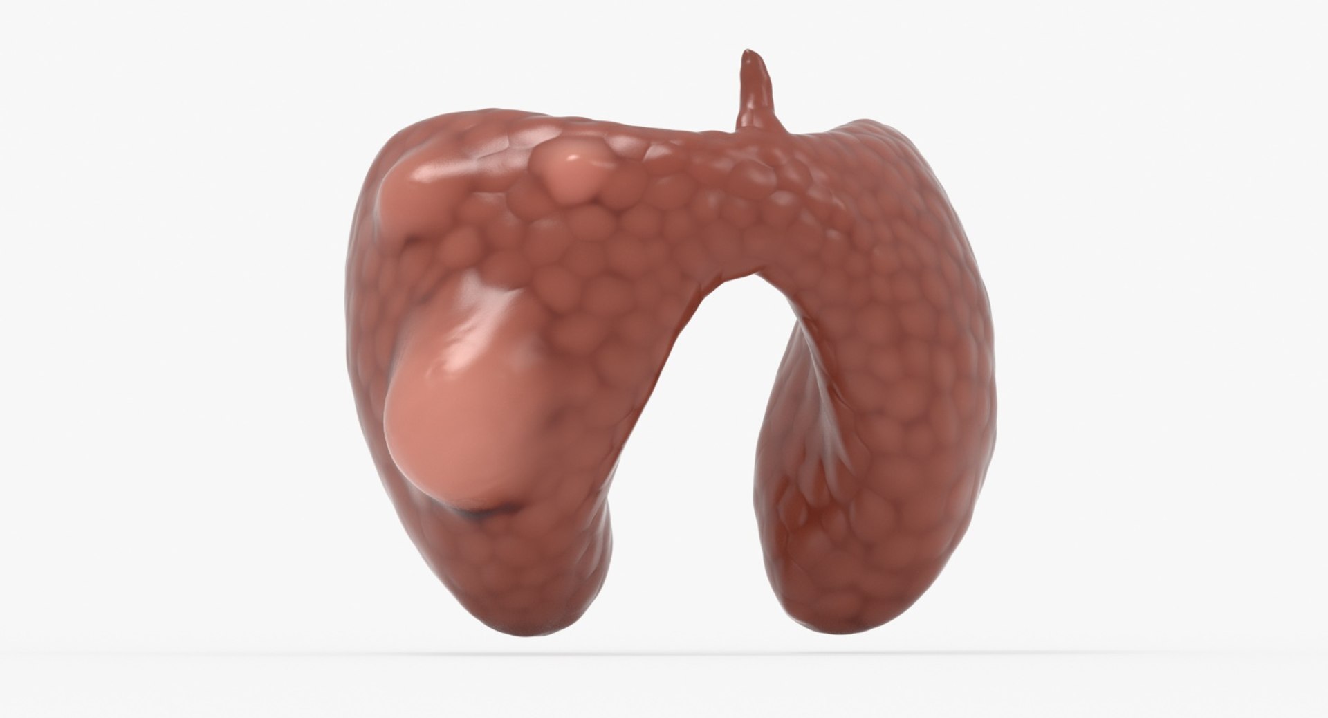 papillary cancer thyroid 3D model https://p.turbosquid.com/ts-thumb/oe/kvoIUx/xzkyYePW/02_signature_image_cinema/jpg/1546076093/1920x1080/fit_q87/06b133cd0d17dc2bb7bc2cdb85f1bd133a54d175/02_signature_image_cinema.jpg