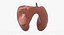 Papillary Cancer Thyroid