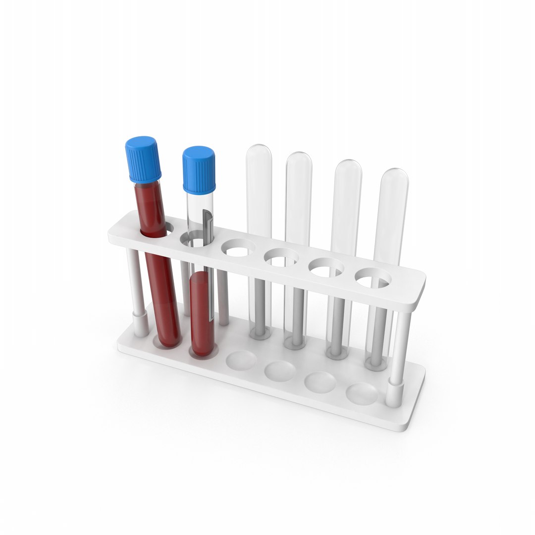 3D Test Tube Rack Covid-19 Tests https://p.turbosquid.com/ts-thumb/ol/ETVbU2/C9/covid19positivetesttuberack.f10.2k/png/1645814881/1920x1080/fit_q87/18680f4dd9bd4186a68145b8001d37088e34d0cb/covid19positivetesttuberack.f10.2k.jpg
