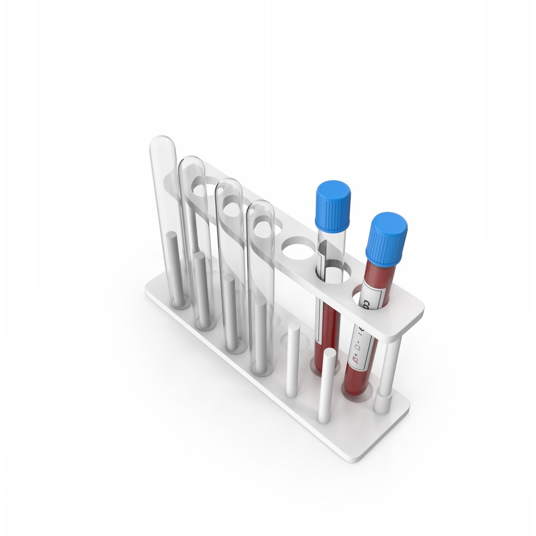 3D Test Tube Rack Covid-19 Tests https://p.turbosquid.com/ts-thumb/ol/ETVbU2/px/covid19positivetesttuberack.e03.2k/png/1645814946/1920x1080/fit_q87/a5e7904d80120ff5468193766d5c12b32659ff86/covid19positivetesttuberack.e03.2k.jpg