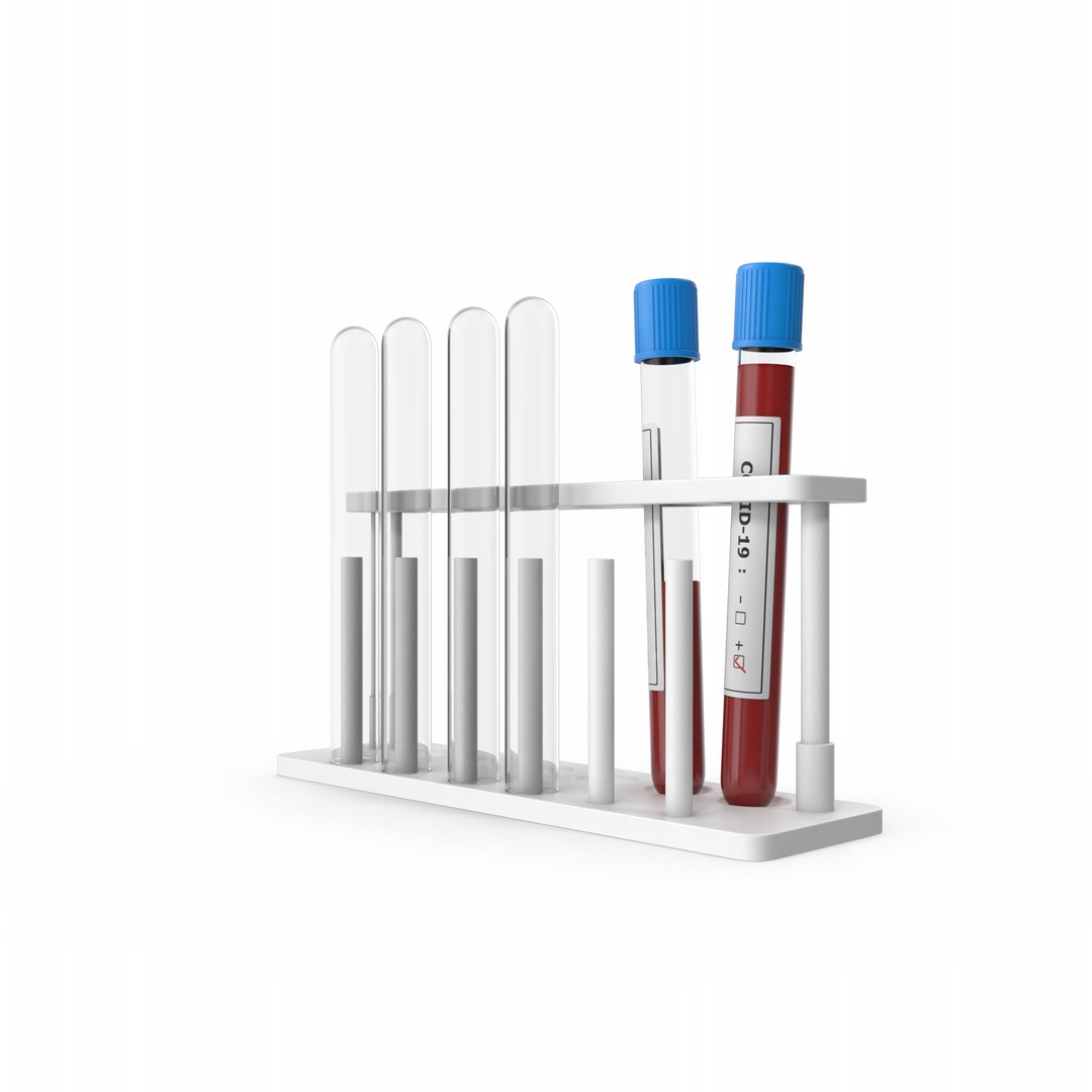 3D Test Tube Rack Covid-19 Tests https://p.turbosquid.com/ts-thumb/ol/ETVbU2/xn/covid19positivetesttuberack.i03.2k/png/1645814870/1920x1080/fit_q87/2443256a093956fe76d9b734afdbe92445a79292/covid19positivetesttuberack.i03.2k.jpg