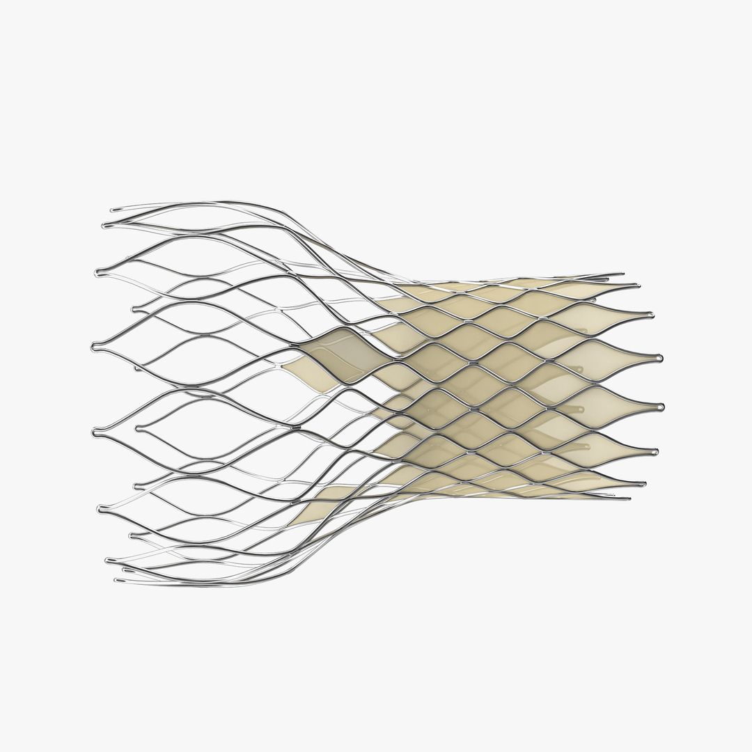 Transcatheter Aortic Implant 3d Model