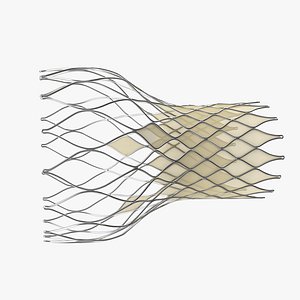 Transcatheter Aortic Implant