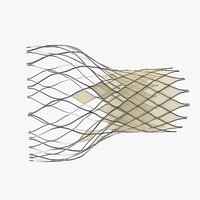 Transcatheter Aortic Implant