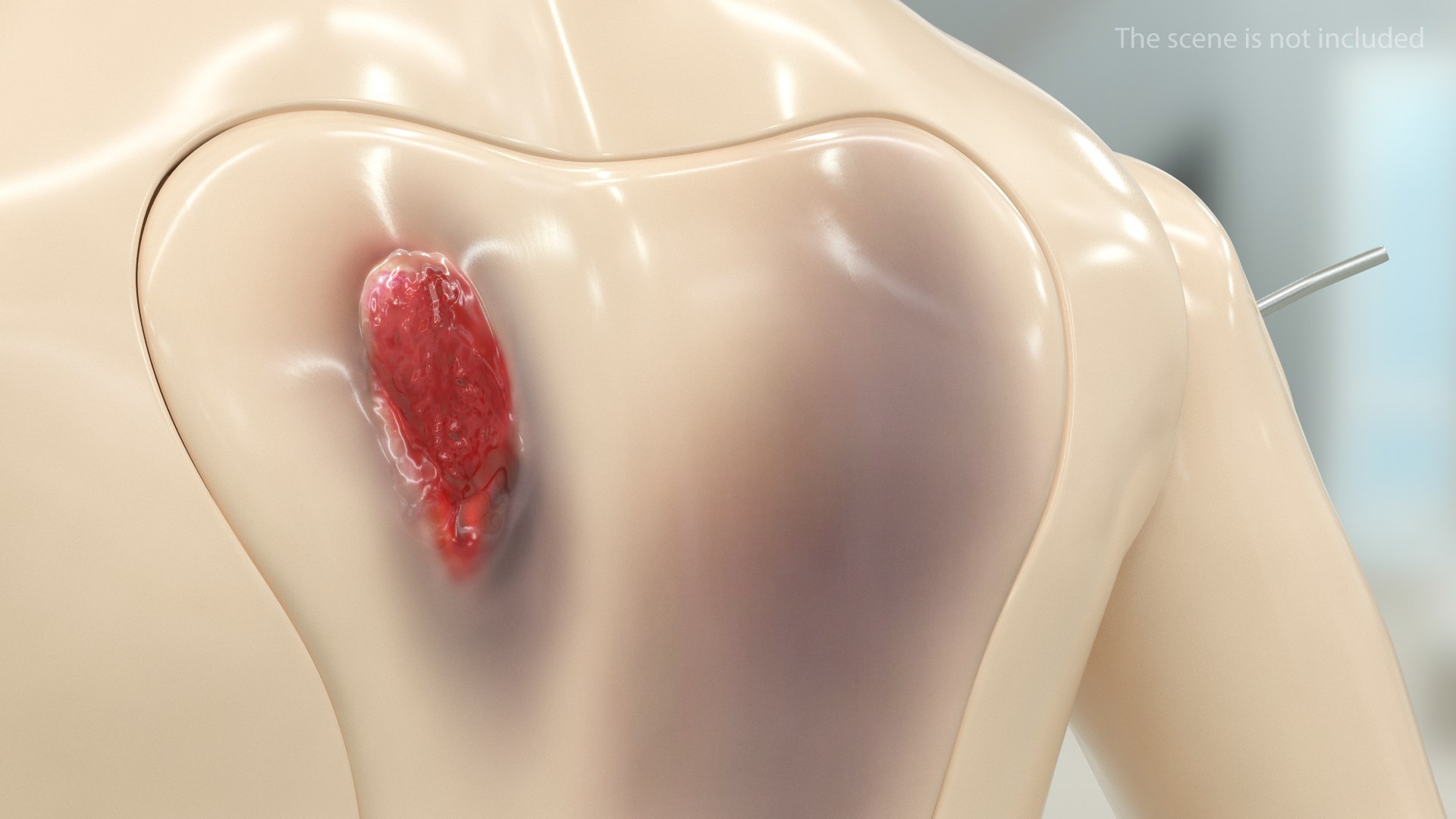 trauma extrication manikin lying model https://p.turbosquid.com/ts-thumb/on/1HC8bN/PvBch1Ro/traumaandextricationmanikinlyingposec4dmodel007/jpg/1582319464/1920x1080/fit_q87/7e8d456ac974d49b308985842c45516179b53d97/traumaandextricationmanikinlyingposec4dmodel007.jpg