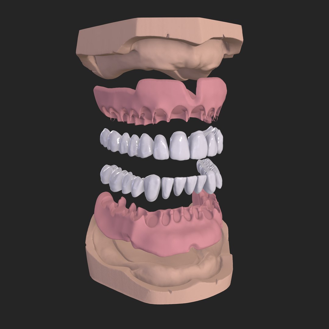 Dental Anatomy Model Real Medical Case3D模型 TurboSquid 2048082