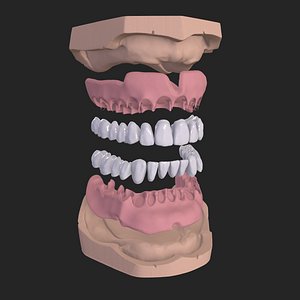 Dental Anatomy Model Real Medical Case