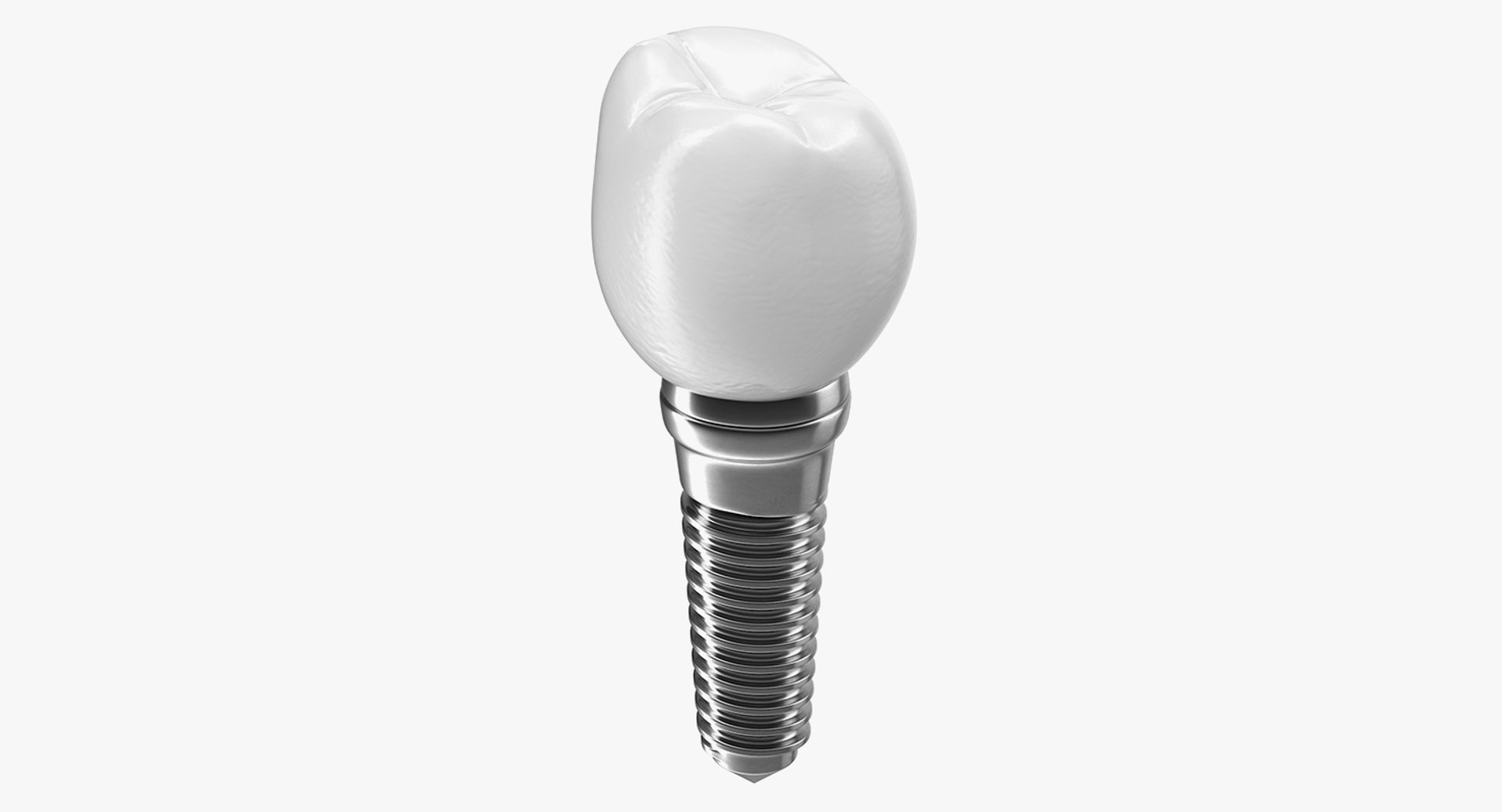 Tooth Dental Implant 3D model preview