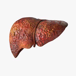 Human Liver Damaged